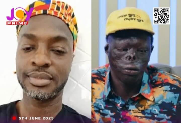 Free Surgery Program